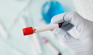 sepsis-vucudun-sessiz-firtinasi-uu7NrzGT.jpg
