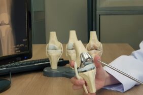 diz kireçlenmesi ameliyatı (2)