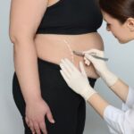 karın germe ameliyatı (3)