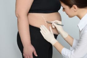 karın germe ameliyatı (3)